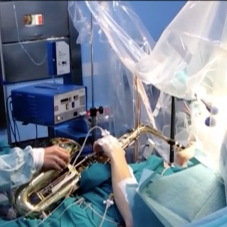 Man plays saxophone while undergoing brain surgery 12 hour operation